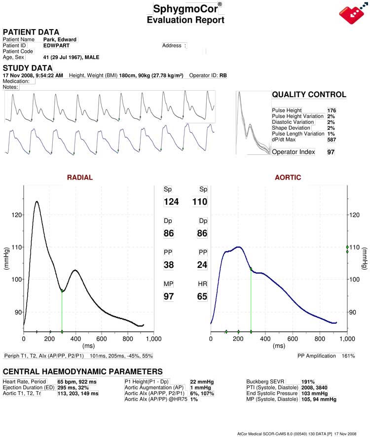heart study